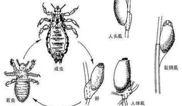 为何30年前农村几乎男女老少都有虱子，现在怎么没有了？虱子是哪里来的？