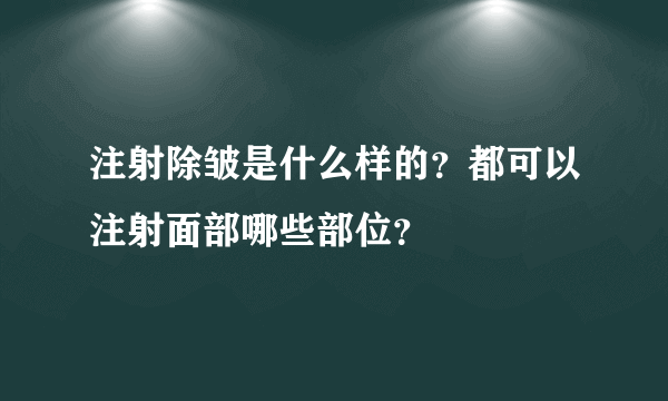 注射除皱是什么样的？都可以注射面部哪些部位？