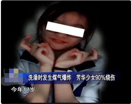 少女洗澡煤气爆炸现在什么情况？