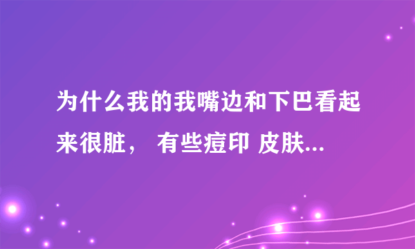 为什么我的我嘴边和下巴看起来很脏， 有些痘印 皮肤暗淡 谁能帮我觉下，我很苦恼