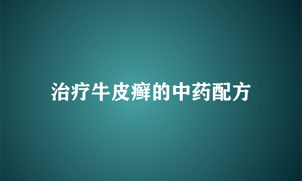 治疗牛皮癣的中药配方