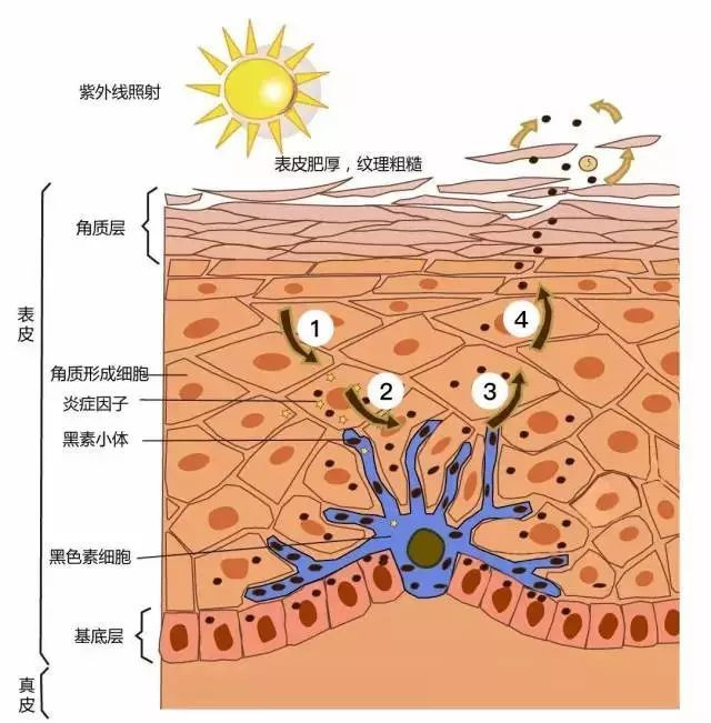 怎么样可以快速去除脸上的黄褐斑呢?我才十八啊!