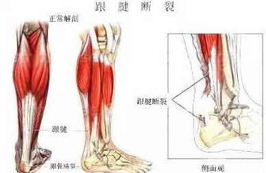 脚底板疼痛是怎么回事？