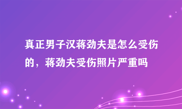 真正男子汉蒋劲夫是怎么受伤的，蒋劲夫受伤照片严重吗