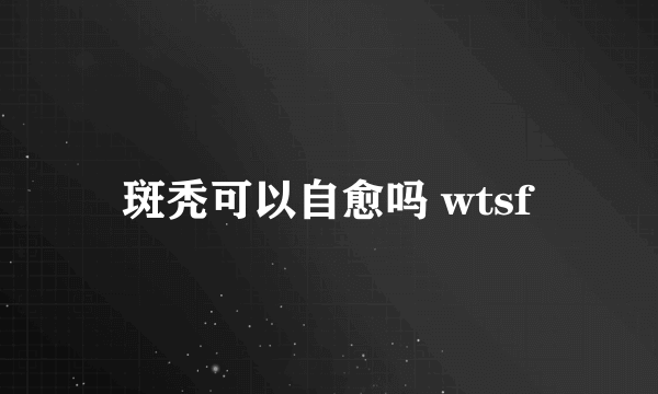 斑秃可以自愈吗 wtsf