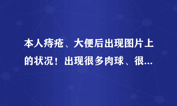 本人痔疮、大便后出现图片上的状况！出现很多肉球、很吓人、这是属于外痔还是内痔？这种情况严重么？需要