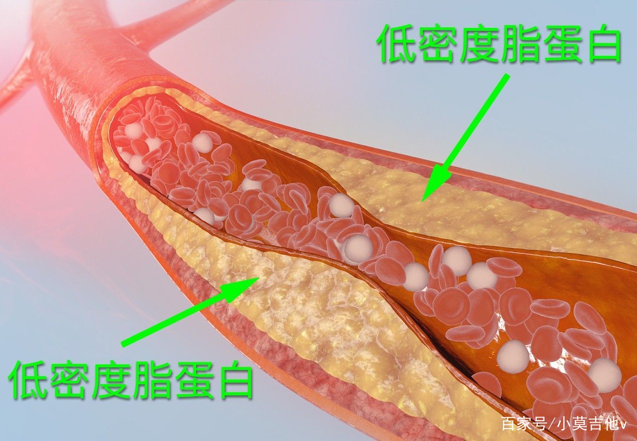 怎么才能提高高密度脂蛋白，降低低密度脂蛋白？